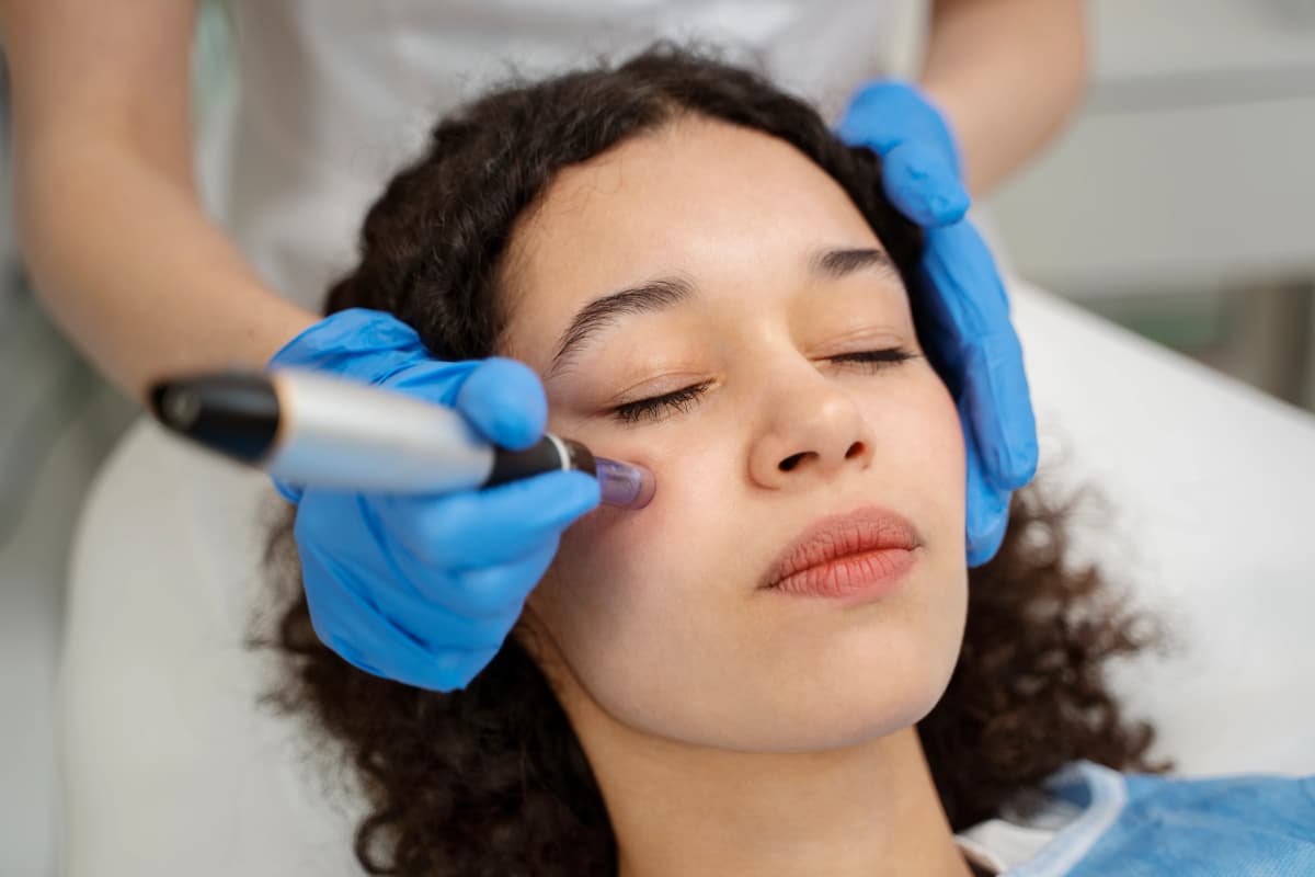 Microneedling tretmaž - naravna regeneracija kože za mladosten videz