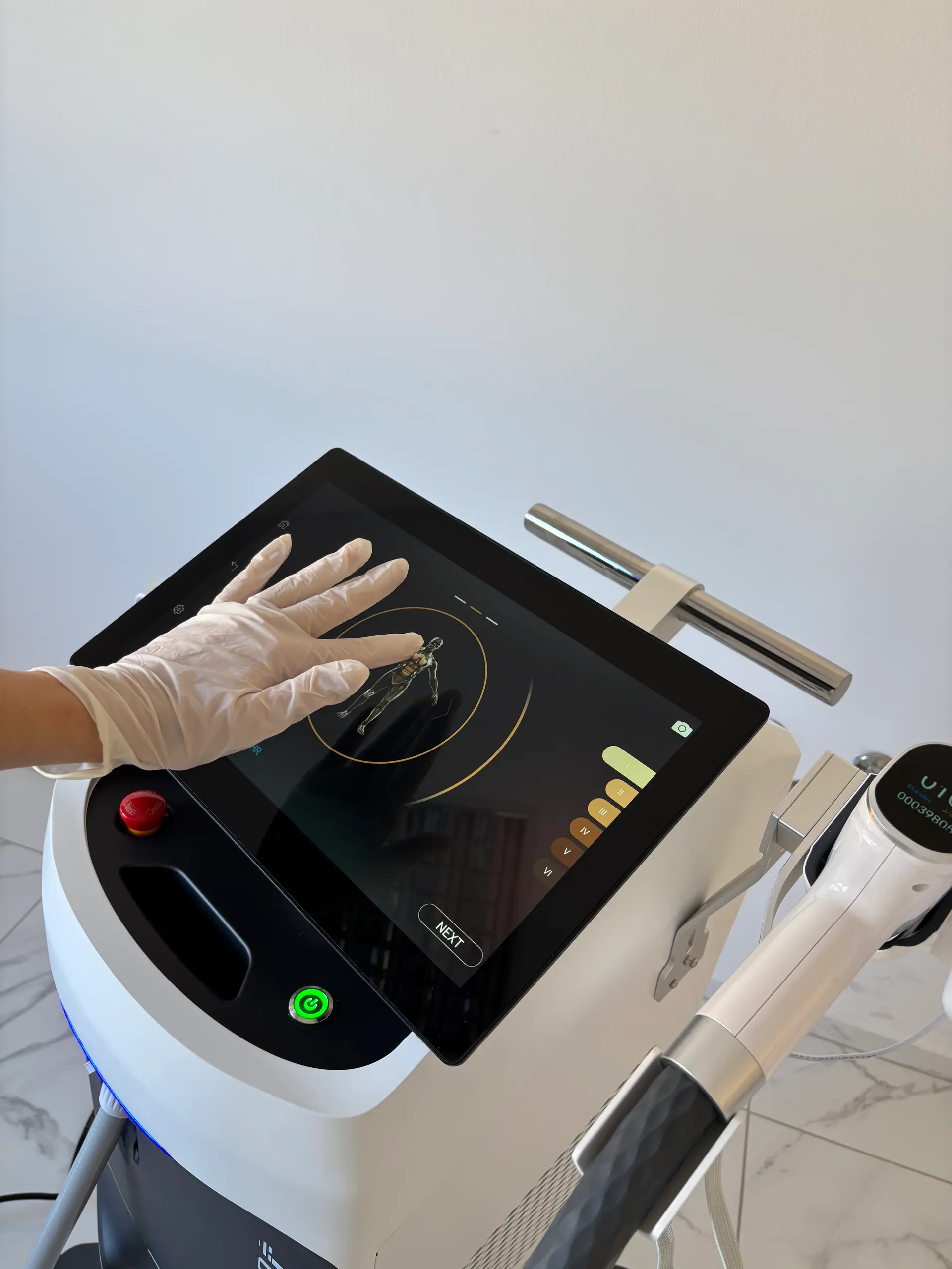 Diodni laser v Lumen Estetiki